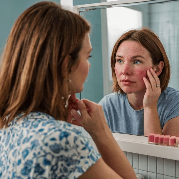 مراقبت از پوست