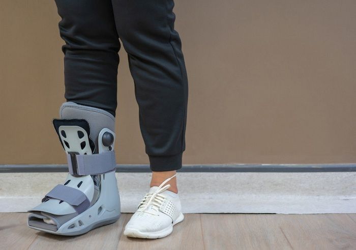 درمان انواع مشکلات کف پا با فیزیوتراپی، بریس و ورزش