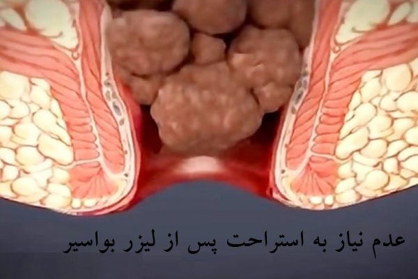 دکتر خانم متخصص هموورئید در غرب تهران