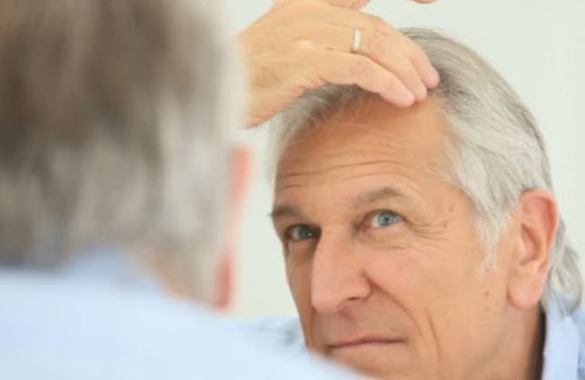 5 بیماری که باعث ریزش مو در سالمندان می گردد